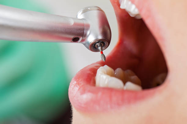 Best Knocked-Out Tooth Emergency  in Red Oaks Mill, NY